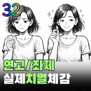 참약사 대장약국 | 치열 치료 시 연고와 좌제 체감 차이
