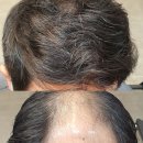 헤어샵오늘 이미지