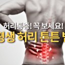 오늘의 건강. 허리가 아픈 사람들 꼭 읽어 보세요 이미지