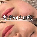한끗 에스테틱