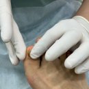 제이비 | 한남동풋케어 굳은살 발관리 전문 제이비풋 굳은살&amp;발톱 케어 후기