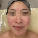 앤바이오 | 광교 에스테틱 엘트리움스킨앤바디 수원광교점 바이오필 리얼 후기