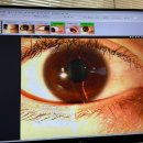 새로운세상안과의원 네이버블로그