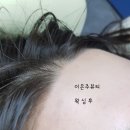 이은주헤어라인