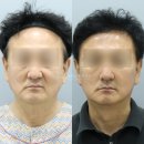 거상광고