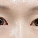 알프스안경위드렌즈 이미지