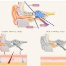 외이도염 원인 검사 예방 이미지