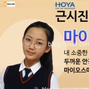 대학병원안경 이미지