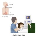 위궤양 증상과 치료법 이미지