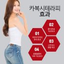 엔비테라피 이미지
