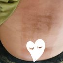 황제쑥뜸 이미지