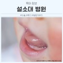 고운가이드치과병원 | 설소대 병원 3단계 수술 결정 가이드 아빠 실전 후기