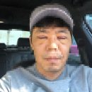 김종철성형외과의원 | 눈 밑 지방재배치 수술 -2주차-