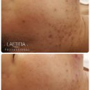 천안 RPC 이미지