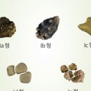 라임비뇨의학과의원 네이버블로그