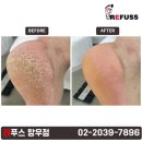 레푸스 망우점 이미지