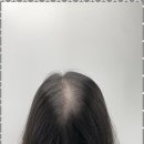 건강두피모발관리 이미지