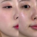 포들포들 | 클렌징밤 사용법, 씨스타 소유가 PICK 한 올인원 클렌저 포들 밤투폼 사용 후기와 추천