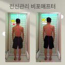 (주)아이엠대화 | [수성구 남자 목관리] 60대 남성 굳은 목과 어깨 등 관리 후 잠 잘 잤어요.