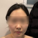 민스킨케어 | 성북구 웨딩케어 피부샵 축소 윤곽관리 민스킨앤바디 후기