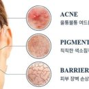 수지스킨케어