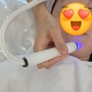 에이원 | 구미 에이원뷰티 아쿠아필 후기 모공 정리,환절기 필수관리