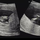 압구정함춘산부인과의원 이미지