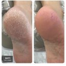 엠블케어 이미지