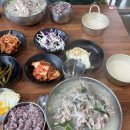 2월 기록 닥터아이씨엘 안과 렌즈삽입술 후기