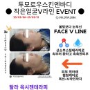 진스킨엔바디 네이버블로그