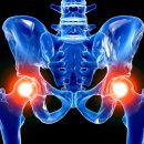 중앙정형외과의원 이미지