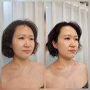 반송동130 | 동탄얼굴비대칭 안면윤곽 반송동 휴에스테틱