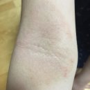 휴앤코스메틱 | 나나자레 진짜 대박 이예요!!! 실제 사용 후기 입니다