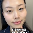 스킨노플(SKINNOPLE)
