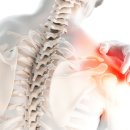 바른재활의학과의원 | 🩺 겨울철 어깨통증 원인과 치료방법｜체외충격파·프롤로주사로 비수술 치료 (척바른재활의학과의원)