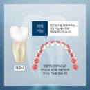 기장이튼튼치과의원 네이버블로그