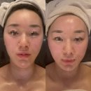 배BEAUTY | [약손명가 개포점] 연예인관리 K-beauty A (후기,주차,비용,전후사진)