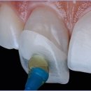 수플러스치과기공소 이미지