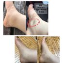 바디픽스 이미지