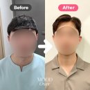 남자 머리 스타일 컨설팅