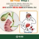 담석, 담석증 원인 증상 - 복부 우측 위쪽이 아플 경우 - 진흙 같은 회색의 대변이라면 이미지