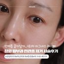 아그네스뷰티 | 창원 피부과 한관종 4회차 리얼 후기｜아그네스 레이저 가격, 부작용, 시술 횟수 정리