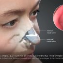 뉴진성형외과 이미지