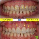 진치과기공소 이미지