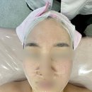 한양홈마트 | 금광동피부샵 올가드림뷰티에서 모공클렌징과 물방울피부관리 받고온 후기