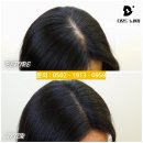 환경UP | 의정부 두피문신 시술후기 헤어라인 교정으로 자신감 UP!