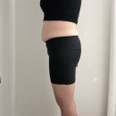 H-2 | 대전 1:1 다이어트병원 세심한 H클리닉 지방분해주사 2주 후기