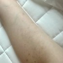 여기모두 | [청량리 팔뚝 관리] 팔뚝부자예신들 모두 여기 모여라 내돈내산후기 “유포리아”