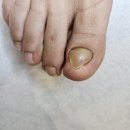 구로-구로-구로-2236 | 금천 구로디지털단지 내성발톱 당뇨인도 안심하고 받을 수 있는 관리샵 오벨리네일푸스 족보있는그녀들...