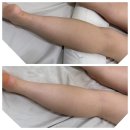 바디 스킬 릴리즈 | 산본 하체슬리밍관리 시절에스테에서 종아리부종 고민해결 후기